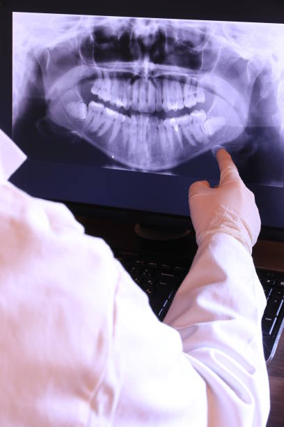 Best Emergency Dental Services for Seniors in Salamanca, NY